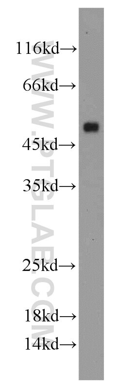 HEK-293 cells were subjected to SDS PAGE followed by western blot with 18374-1-AP(ANGPTL4 Antibody) at dilution of 1:1000 ANGPTL4 western blot WB 18374-1-AP ANGPTL4 Antibody ANGPTL2; ARP4; FIAF; HFARP; NL2; PGAR; pp1158