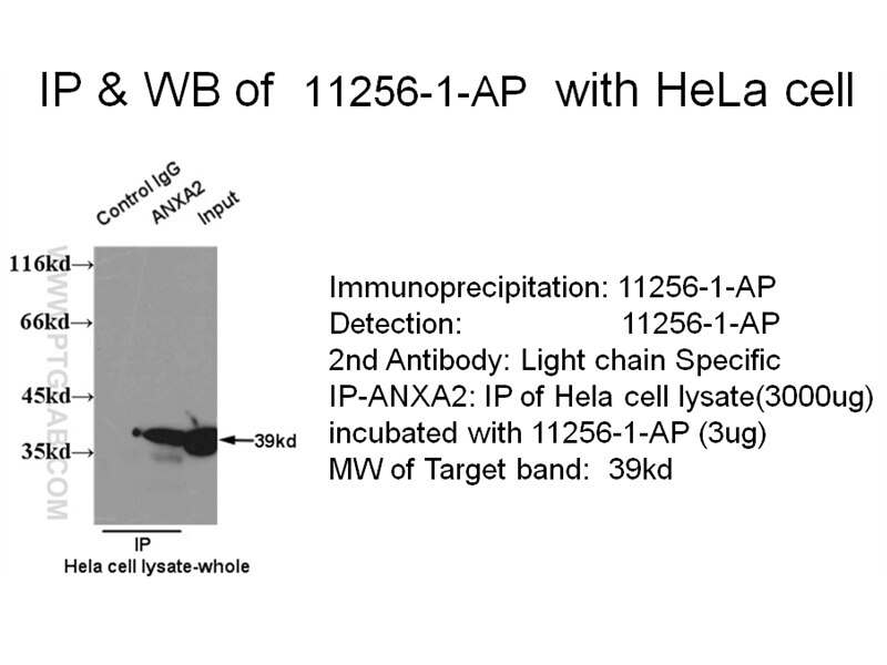 ANXA2 IP 11256-1-AP ANXA2 Antibody ANX2; ANX2L4; CAL1H; LIP2; LPC2; LPC2D; P36; PAP-IV