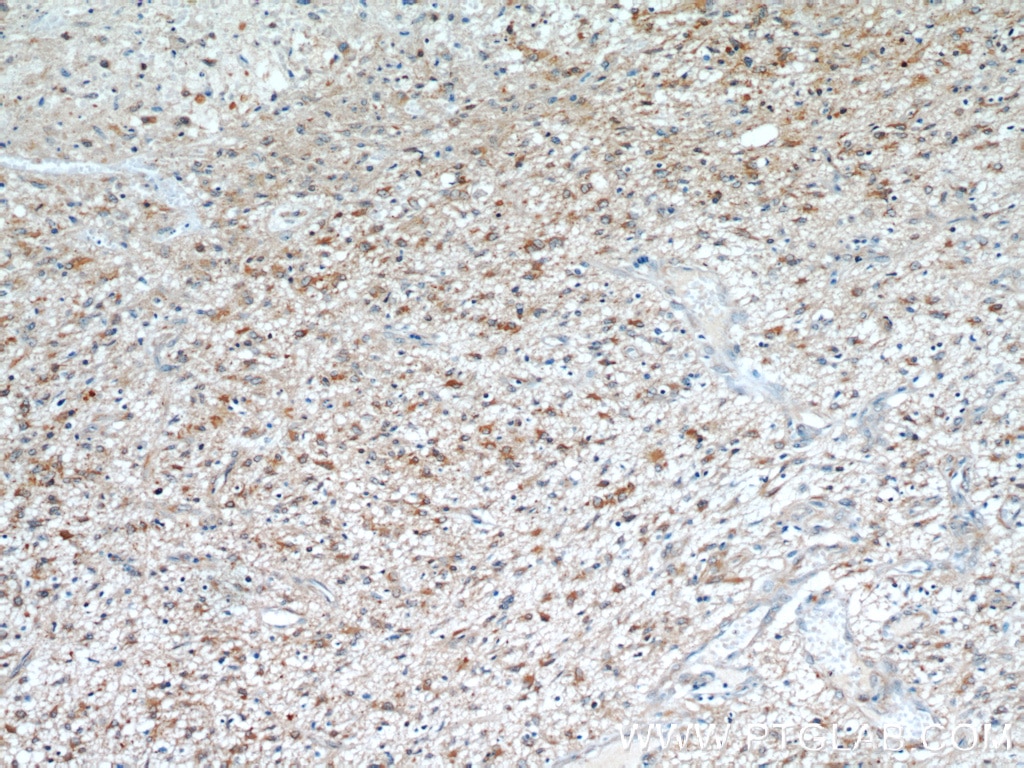 ANXA2 IHC Immunohistochemical 66035-1-Ig ANXA2 Antibody ANX2; ANX2L4; CAL1H; LIP2; LPC2; LPC2D; P36; PAP-IV