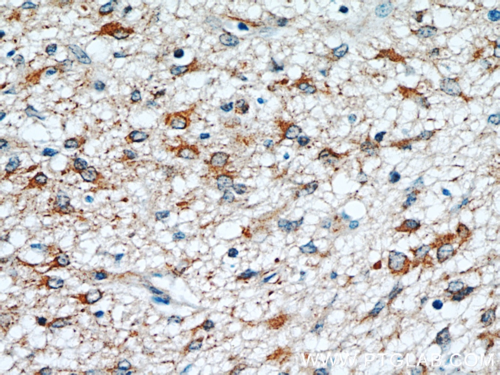 ANXA2 IHC Immunohistochemical 66035-1-Ig ANXA2 Antibody ANX2; ANX2L4; CAL1H; LIP2; LPC2; LPC2D; P36; PAP-IV