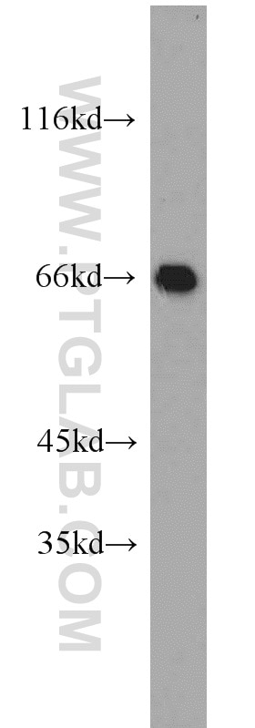 mouse brain tissue were subjected to SDS PAGE followed by western blot with 12542-1-AP(ANXA6 Antibody) at dilution of 1:500 ANXA6 western blot WB 12542-1-AP ANXA6 Antibody ANX6; CBP68