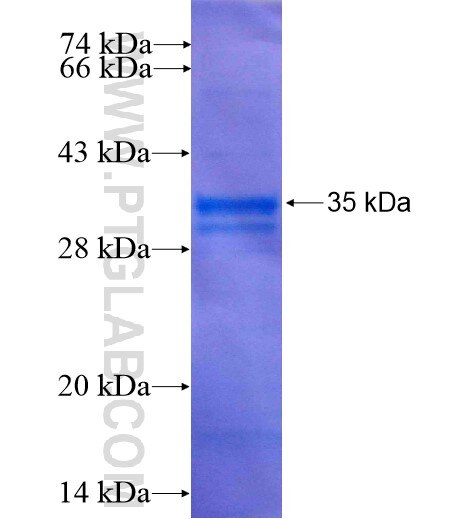 AP2A2 fusion protein ag8450 SDS-PAGE