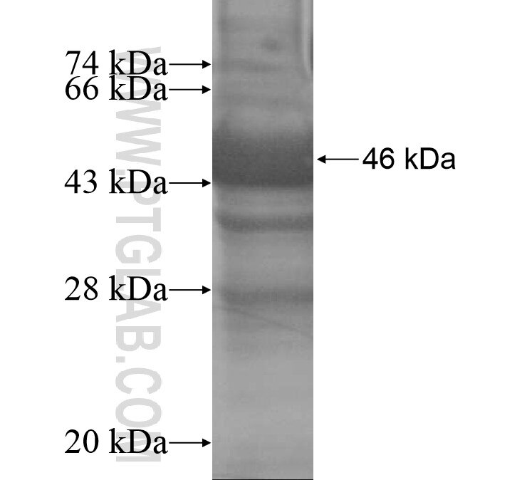 APCS fusion protein ag14765 SDS-PAGE