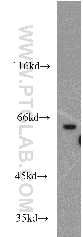 PC-3 cells were subjected to SDS PAGE followed by western blot with 14252-1-AP(APLF Antibody) at dilution of 1:600 APLF western blot WB 14252-1-AP APLF Antibody APFL; C2orf13; FLJ16593; MGC47799; PALF; Xip1