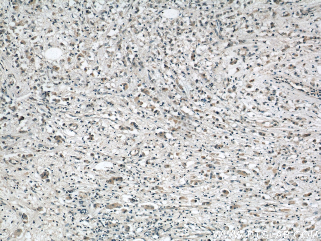 APOBEC3G IHC Immunohistochemical 60100-1-Ig APOBEC3G Antibody ARP9; CEM15; FLJ12740; MDS019; bK150C2.7; dJ494G10.1