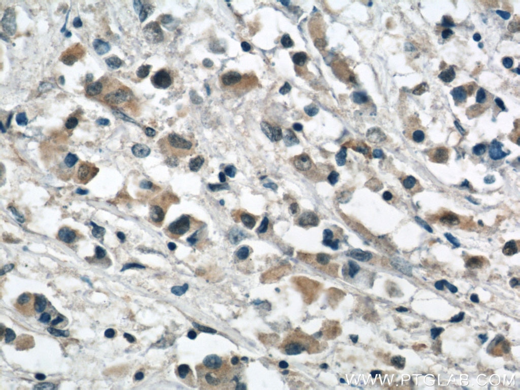 APOBEC3G IHC Immunohistochemical 60100-1-Ig APOBEC3G Antibody ARP9; CEM15; FLJ12740; MDS019; bK150C2.7; dJ494G10.1