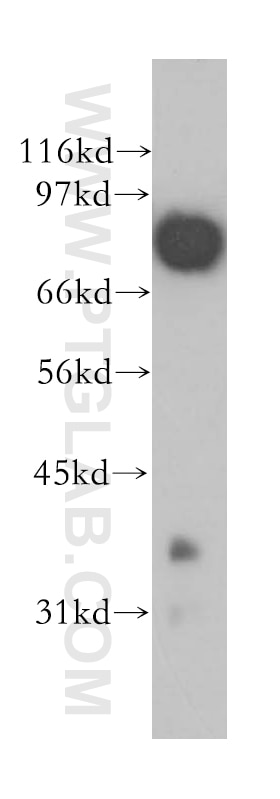 human brain tissue were subjected to SDS PAGE followed by western blot with 12639-1-AP(APPL1 Antibody) at dilution of 1:1500 APPL1 western blot WB 12639-1-AP APPL1 Antibody APPL; DIP13alpha