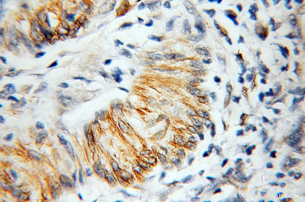 ARF4 IHC Immunohistochemical 11673-1-AP ARF4 Antibody ARF2