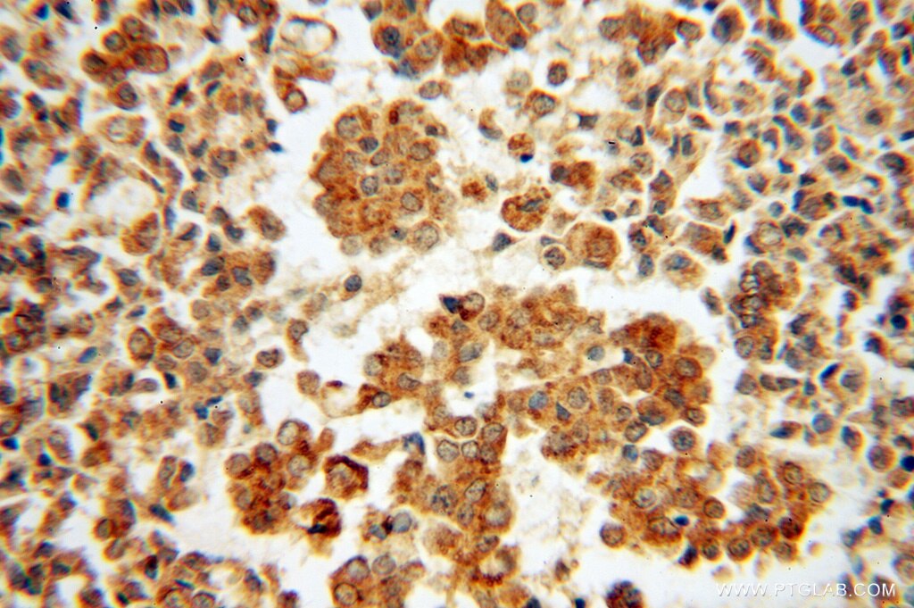 ARF5 IHC Immunohistochemical 15281-1-AP ARF5 Antibody 