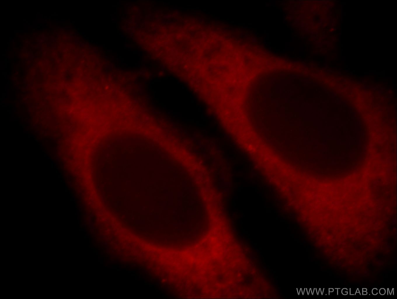 Immunofluorescent analysis of HepG2 cells, using ARF5 antibody 20227-1-AP at 1:25 dilution and Rhodamine-labeled goat anti-rabbit IgG (red). ARF5-Specific Immunofluorescence IF 20227-1-AP ARF5-Specific Antibody