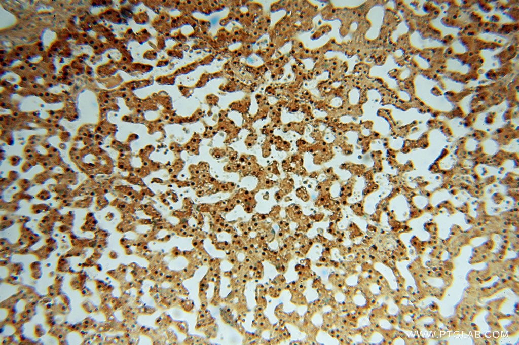 ARG1 IHC Immunohistochemical 16001-1-AP ARG1 Antibody 