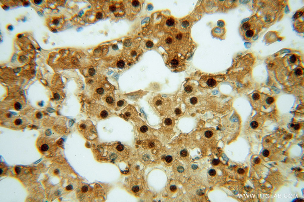 ARG1 IHC Immunohistochemical 16001-1-AP ARG1 Antibody 