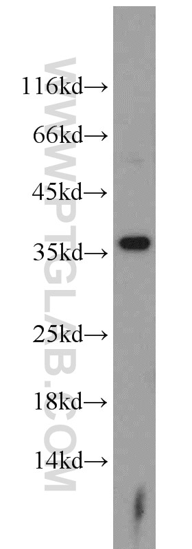 ARG1 western blot WB 16001-1-AP ARG1 Antibody 