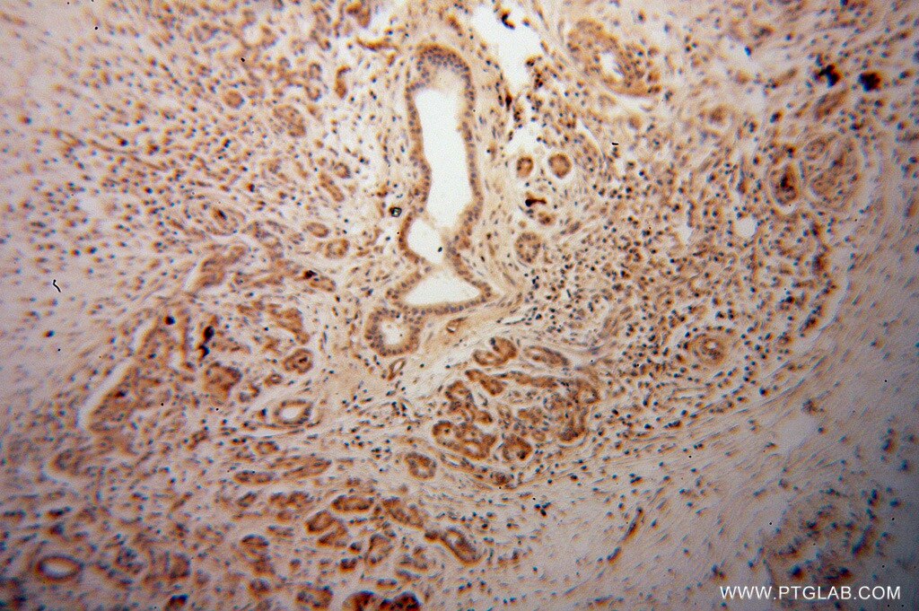ARHGDIG IHC Immunohistochemical 14282-1-AP ARHGDIG Antibody RHOGDI-3