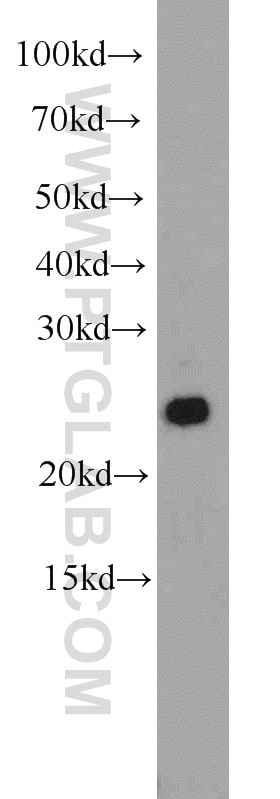 ARHGDIG western blot WB 14282-1-AP ARHGDIG Antibody RHOGDI-3