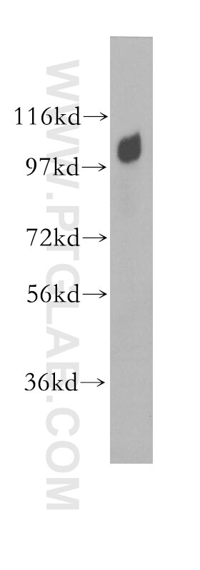 HEK-293 cells were subjected to SDS PAGE followed by western blot with 11363-1-AP(ARHGEF1 Antibody) at dilution of 1:1500 ARHGEF1 western blot WB 11363-1-AP ARHGEF1 Antibody GEF1; LBCL2; LSC; P115-RHOGEF; SUB1.5