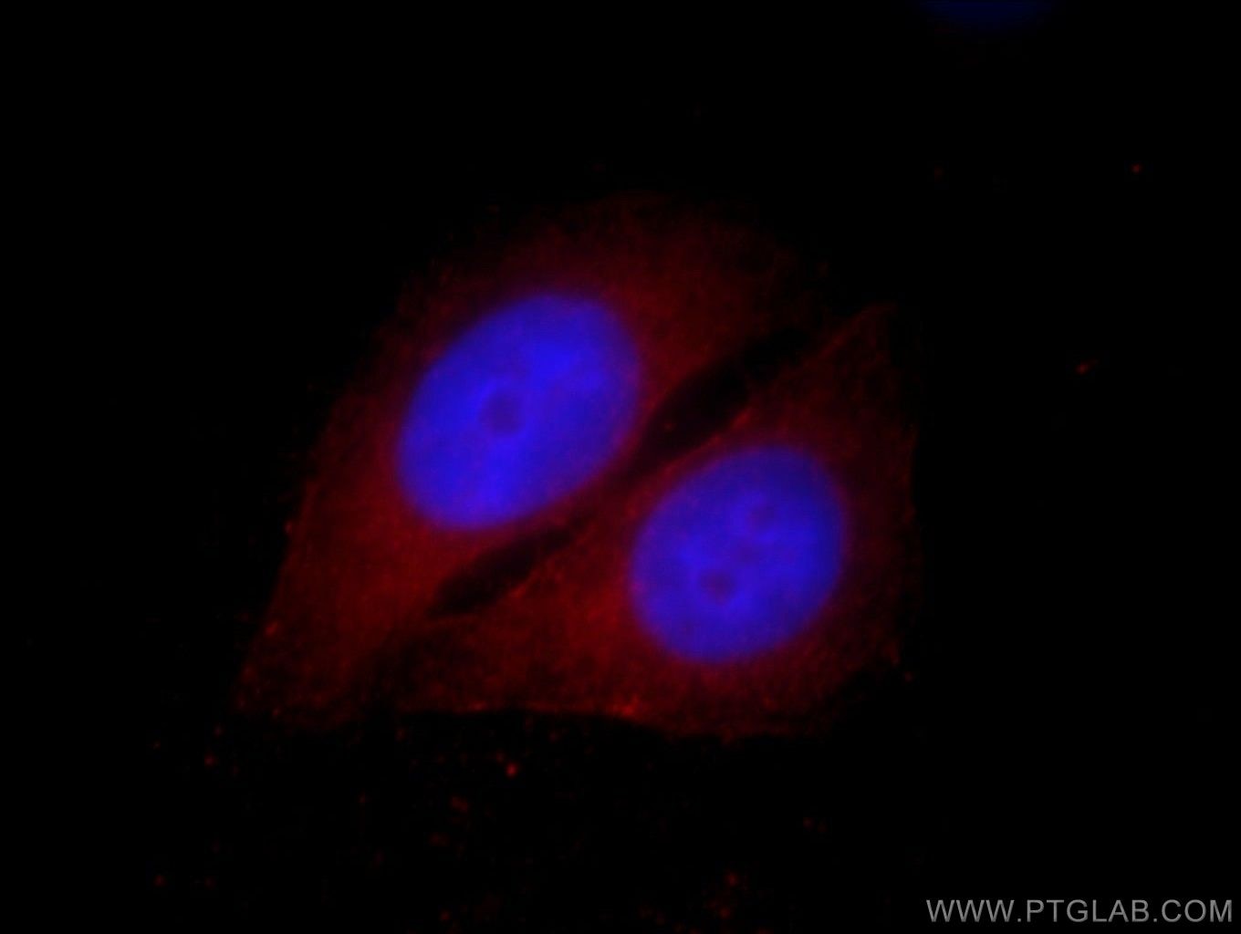 ARL5B Immunofluorescence IF 11694-1-AP ARL5B Antibody ARL8