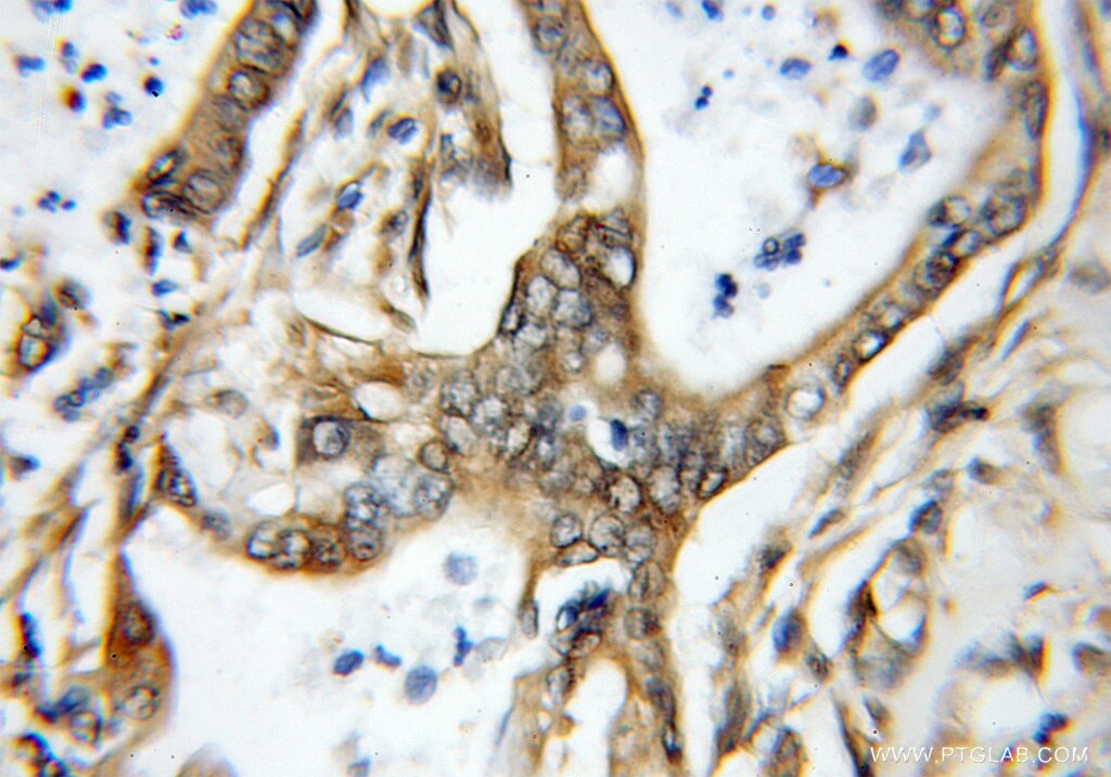 ARL5B IHC Immunohistochemical 11694-1-AP ARL5B Antibody ARL8