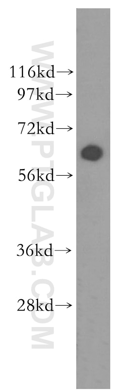 SH-SY5Y cells were subjected to SDS PAGE followed by western blot with 11274-1-AP(ASAH1 Antibody) at dilution of 1:600 ASAH1 western blot WB 11274-1-AP ASAH1 Antibody AC; ASAH; FLJ21558; FLJ22079; PHP; PHP32