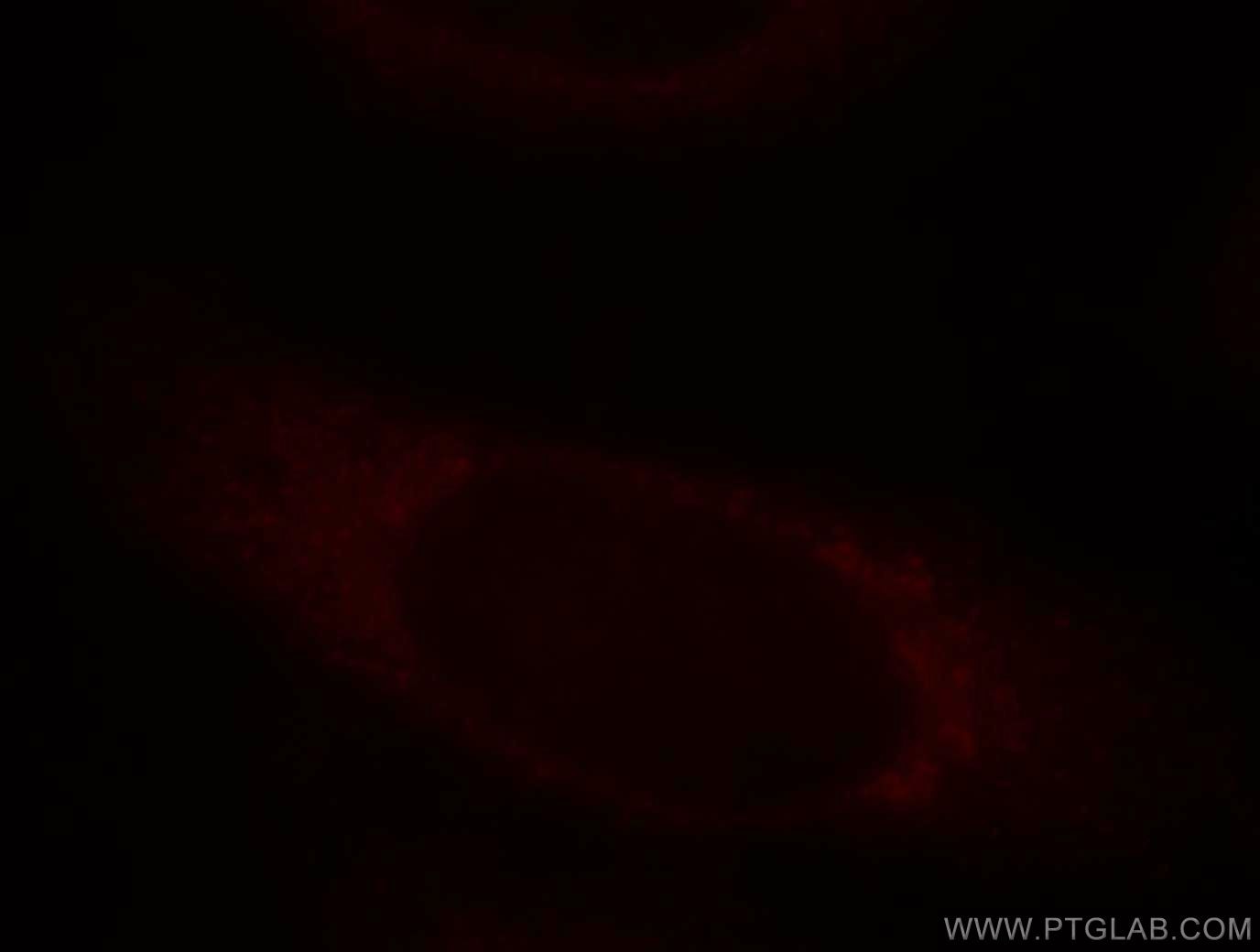 ASAP3 Immunofluorescence IF 14099-1-AP ASAP3 Antibody ACAP4; CENTB6; DDEFL1; FLJ20199; UPLC1