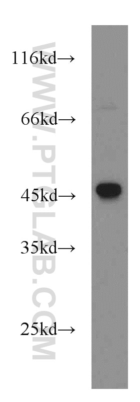 HEK-293 cells were subjected to SDS PAGE followed by western blot with 16210-1-AP(ASS1 Antibody) at dilution of 1:1000 ASS1 western blot WB 16210-1-AP ASS1 Antibody ASS; CTLN1