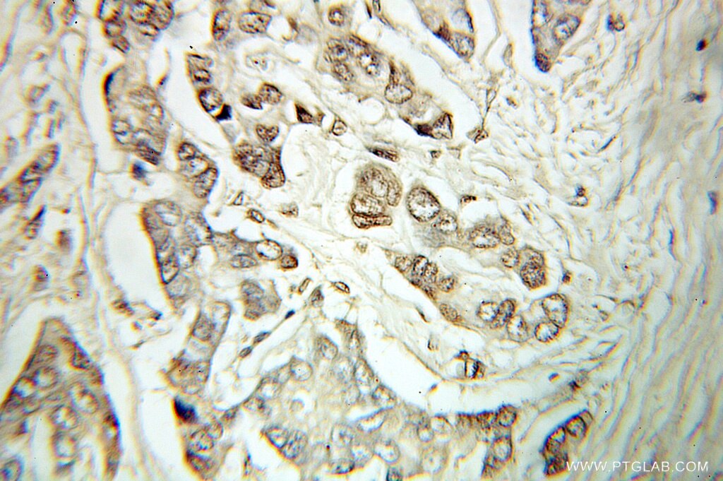 ATF4 IHC Immunohistochemical 10835-1-AP ATF4 Antibody CREB-2; CREB2; TAXREB67; TXREB