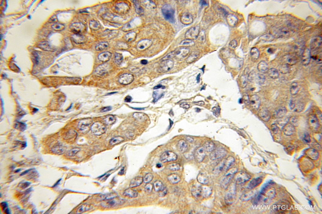 ATG5 IHC Immunohistochemical 10181-2-AP ATG5 Antibody APG5; APG5-LIKE; APG5L; ASP; hAPG5