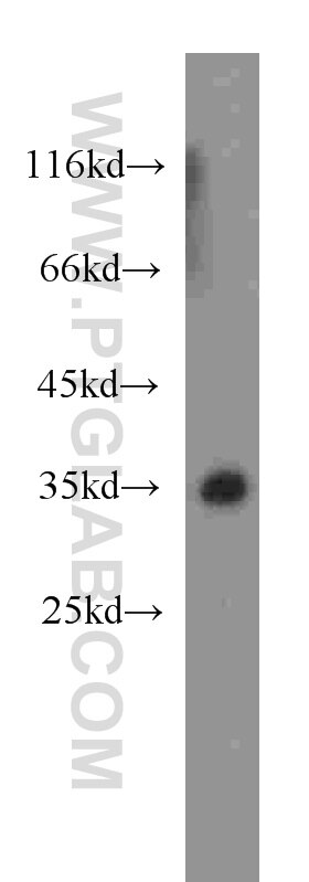 Colo320 cells were subjected to SDS PAGE followed by western blot with 60061-1-Ig(ATG5 Antibody) at dilution of 1:500 ATG5 western blot WB 60061-1-Ig ATG5 Antibody APG5; APG5-LIKE; APG5L; ASP; hAPG5