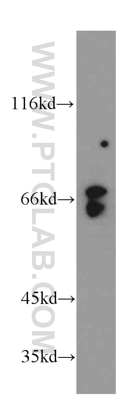 ATIC western blot WB 10726-1-AP ATIC Antibody AICAR; AICARFT; FLJ93545; IMPCHASE; PURH