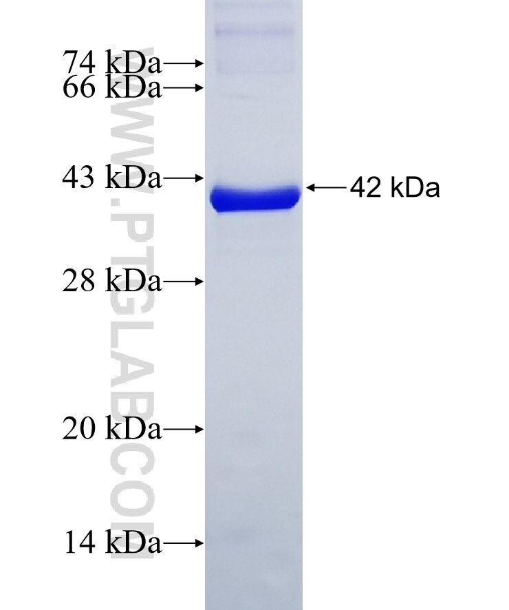 ATP1A1 fusion protein ag5990 SDS-PAGE