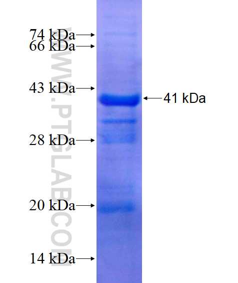 ATP2C1 fusion protein ag14450 SDS-PAGE