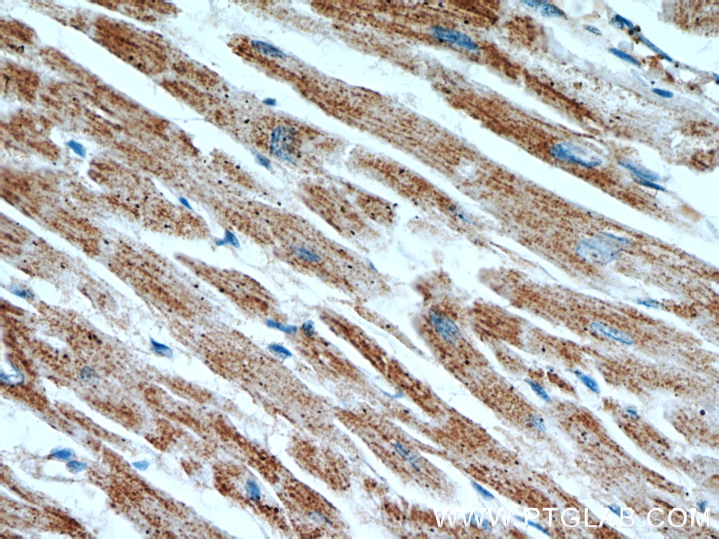 ATP5A1 IHC Immunohistochemical 66037-1-Ig ATP5A1 Antibody ATP5A; ATP5AL2; ATPM; MOM2; OMR; ORM; hATP1