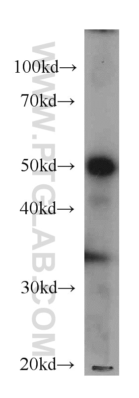 ATP5A1 western blot WB 66037-1-Ig ATP5A1 Antibody ATP5A; ATP5AL2; ATPM; MOM2; OMR; ORM; hATP1