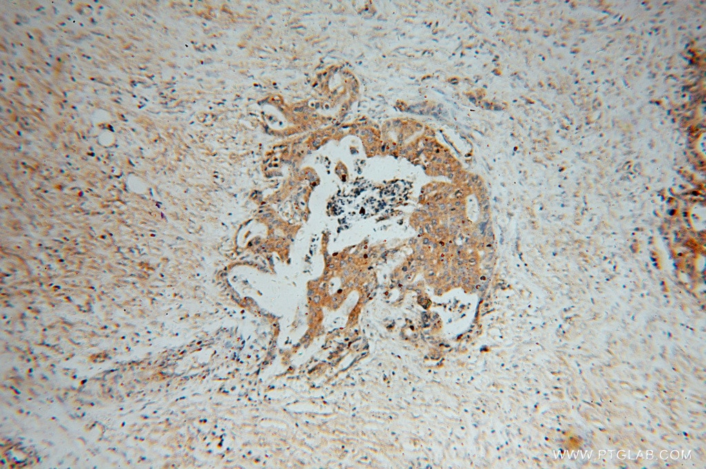 ATP6V1C1 IHC Immunohistochemical 16054-1-AP ATP6V1C1 Antibody ATP6C; ATP6D; FLJ20057; VATC; Vma5