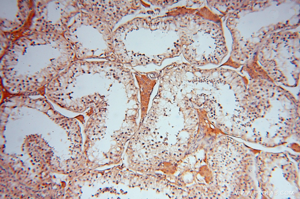 ATP6V1C2 IHC Immunohistochemical 16274-1-AP ATP6V1C2 Antibody ATP6C2; VMA5