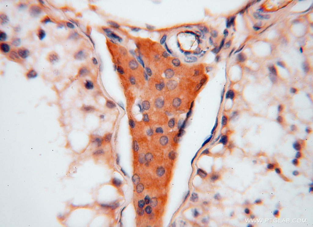 ATP6V1C2 IHC Immunohistochemical 16274-1-AP ATP6V1C2 Antibody ATP6C2; VMA5