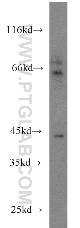 AZGP1 western blot WB 13399-1-AP AZGP1 Antibody ZA2G; ZAG