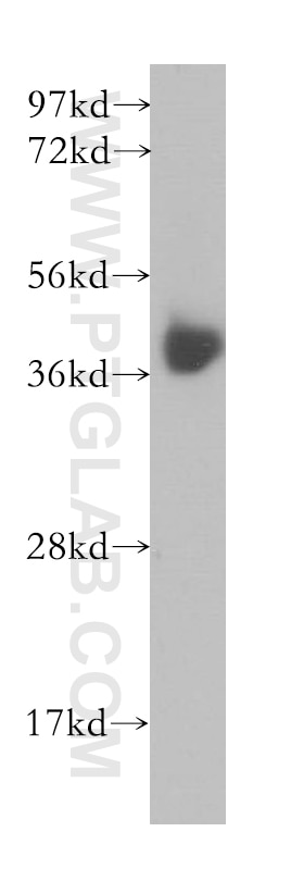 MCF7 cells were subjected to SDS PAGE followed by western blot with 10535-1-AP(B4GALT7 Antibody) at dilution of 1:500 B4GALT7 western blot WB 10535-1-AP B4GALT7 Antibody B4GAL-T7; XGALT-1; XGALT1; XGPT1; beta4Gal-T7