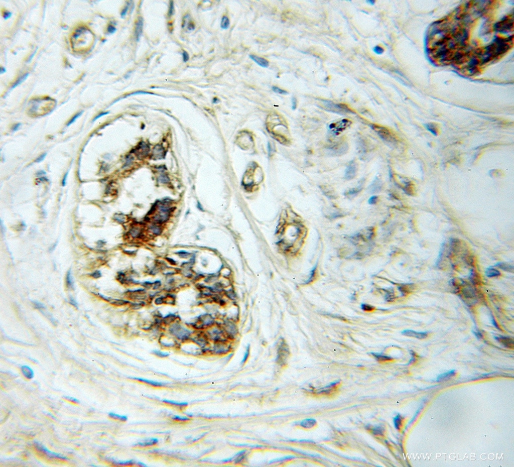 BAIAP2 IHC Immunohistochemical 11087-2-AP BAIAP2 Antibody BAP2; FLAF3; IRSP53