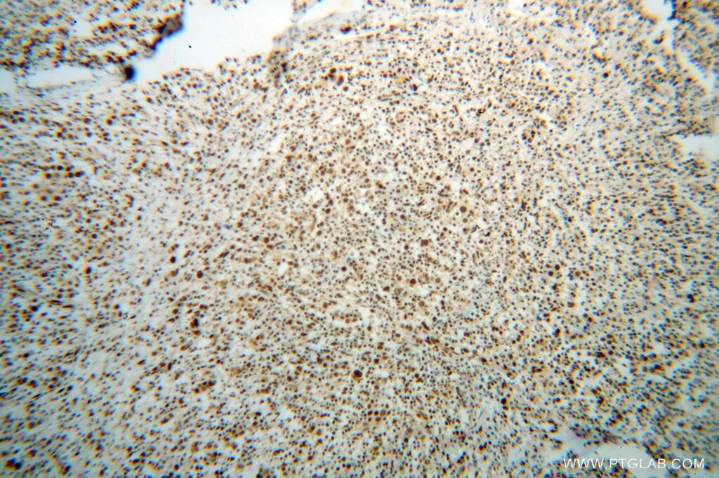 BAT1 IHC Immunohistochemical 14798-1-AP BAT1 Antibody D6S81E; DDX39B; UAP56