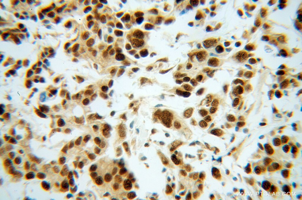 BAT1 IHC Immunohistochemical 14798-1-AP BAT1 Antibody D6S81E; DDX39B; UAP56