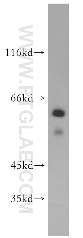 HeLa cells were subjected to SDS PAGE followed by western blot with 12766-1-AP(BBS4 Antibody) at dilution of 1:1000 BBS4 western blot WB 12766-1-AP BBS4 Antibody