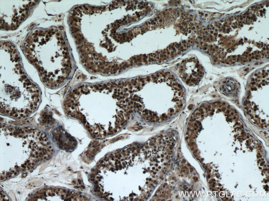 BBS7 IHC Immunohistochemical 18961-1-AP BBS7 Antibody BBS2L1; FLJ10715