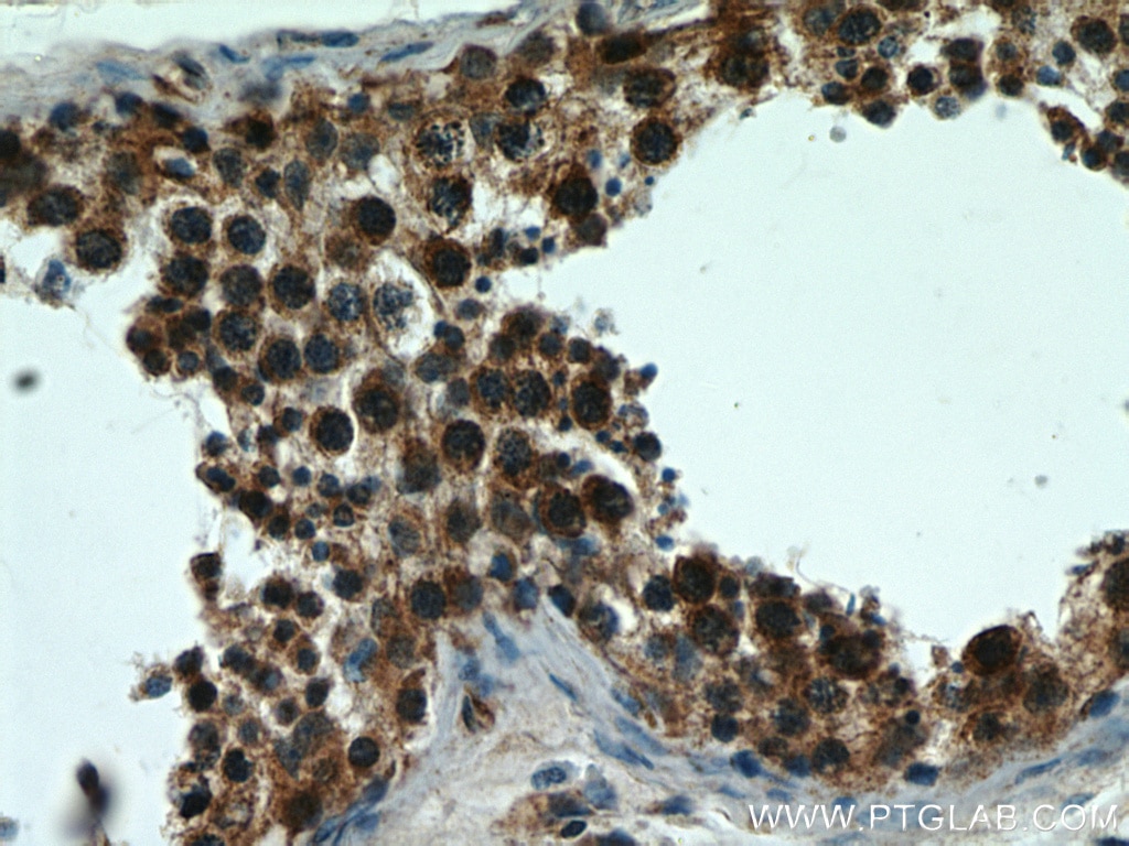 BBS7 IHC Immunohistochemical 18961-1-AP BBS7 Antibody BBS2L1; FLJ10715