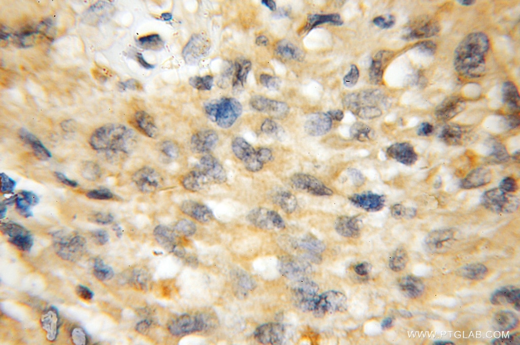 BCL11A IHC Immunohistochemical 11613-1-AP BCL11A Antibody BCL11A-L; BCL11A-S; BCL11A-XL; CTIP1; EVI9; FLJ10173; FLJ34997; HBFQTL5; KIAA1809; ZNF856