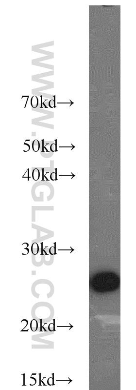 BCL2 western blot WB 12789-1-AP BCL2 Antibody Bcl-2