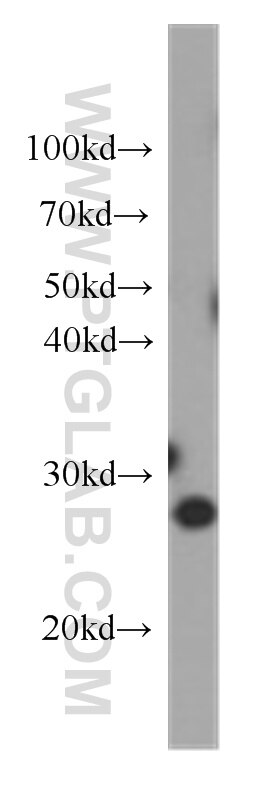 Jurkat cells were subjected to SDS PAGE followed by western blot with 60178-1-Ig(BCL2 Antibody) at dilution of 1:1000 BCL2 western blot WB 60178-1-Ig BCL2 Antibody Bcl-2