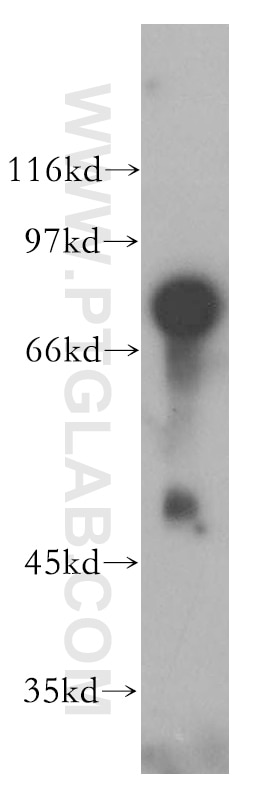 mouse brain tissue were subjected to SDS PAGE followed by western blot with 12688-1-AP(BHLHE41 Antibody) at dilution of 1:1000 BHLHE41 western blot WB 12688-1-AP BHLHE41 Antibody BHLHB3; DEC2; SHARP-1; SHARP1