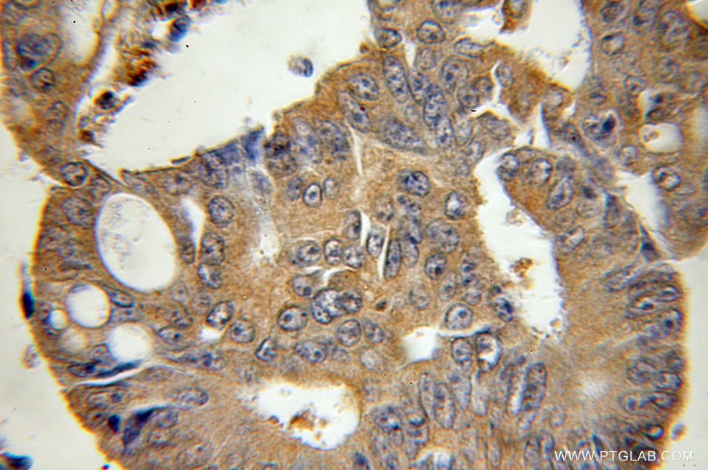 BID IHC Immunohistochemical 10988-1-AP BID Antibody FP497; MGC15319; MGC42355