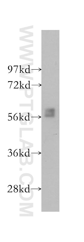 SH-SY5Y cells were subjected to SDS PAGE followed by western blot with 10510-1-AP(BLK Antibody) at dilution of 1:1000 BLK western blot WB 10510-1-AP BLK Antibody MGC10442
